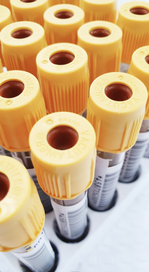 Blood collection tubes in a laboratory rack